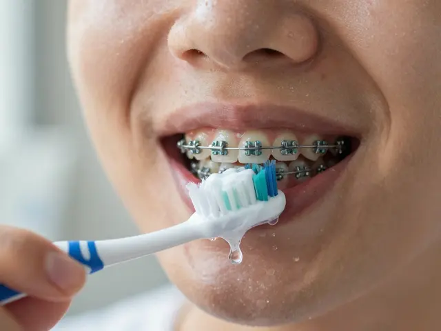 Jak udržet rovnátka v čistotě: Praktické tipy, které skutečně fungují