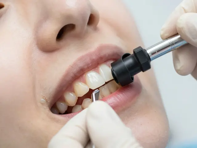 Keramické fazety: Jak udržet jejich lesk a prodloužit životnost