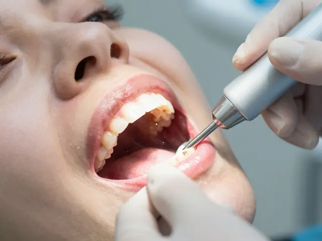 Odstranění zubního kamene: Rychlé a efektivní řešení