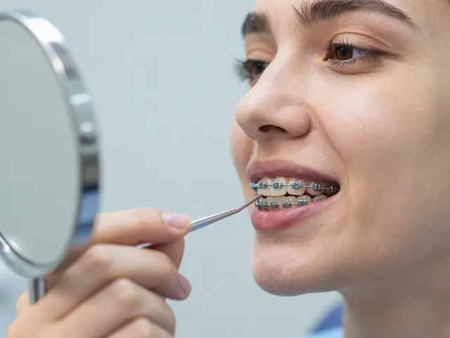 Zničené zuby po rovnátkách: Co na to říkají zubní lékaři?