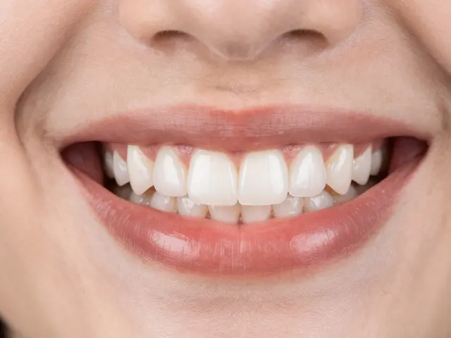 Kompozitní fazety cena: Proč jsou tak oblíbené v roce 2026