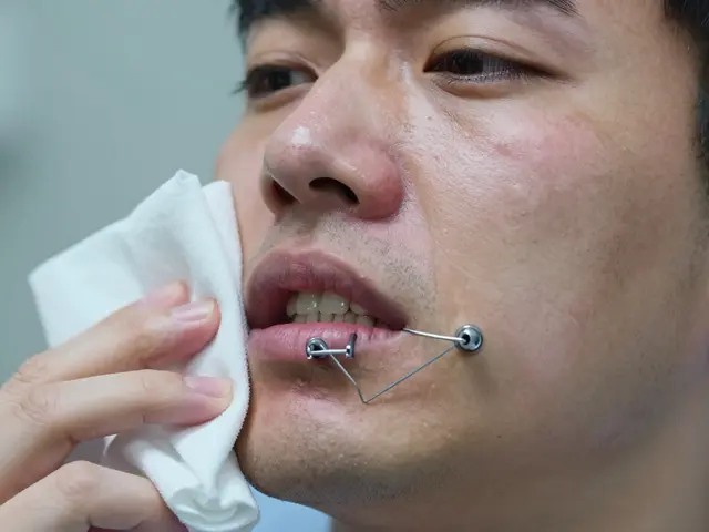 Maxilofaciální chirurgie: Jak probíhá rehabilitace po operaci?